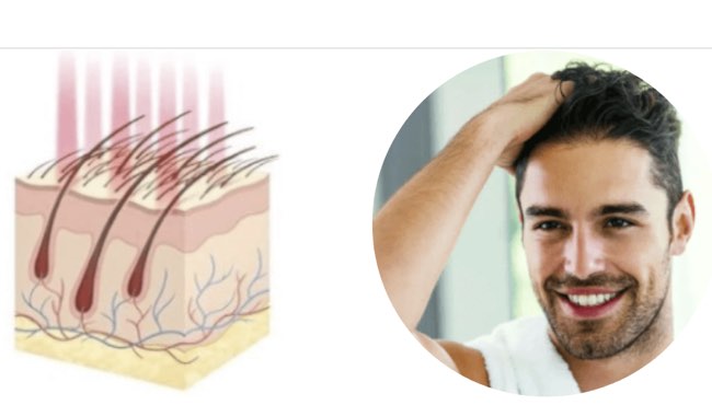 Ridurre la perdita dei capelli e stimolare la ricrescita